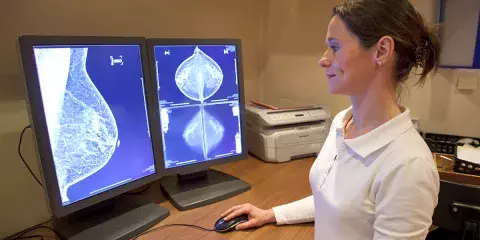 Radiology technician examines mammography test